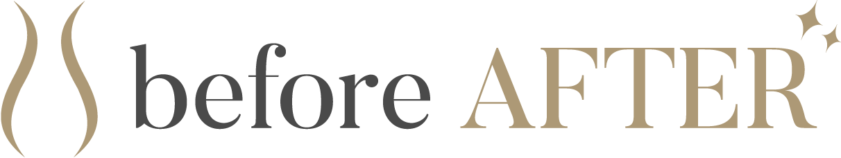 Before After -見るだけダイエット-